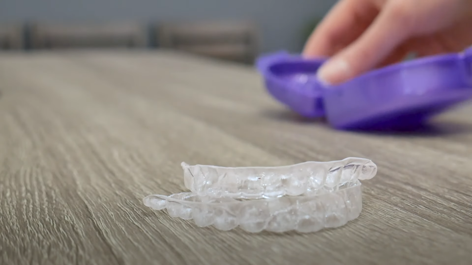 How Much Do Retainers Cost? Price Ranges You Should Know - North ...