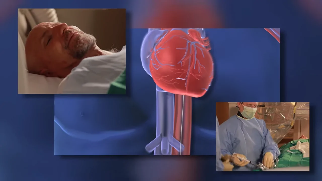 Patient Undergoing an Angiogram Procedure with A Focus on The Heart and Medical Team