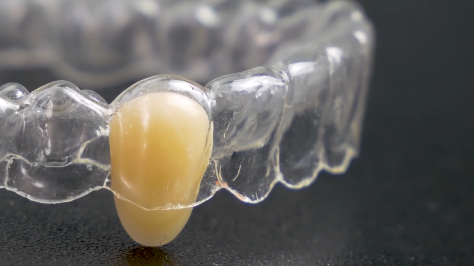 How Much Do Retainers Cost To Replace Plus What Happens If You Dont - sm699qy