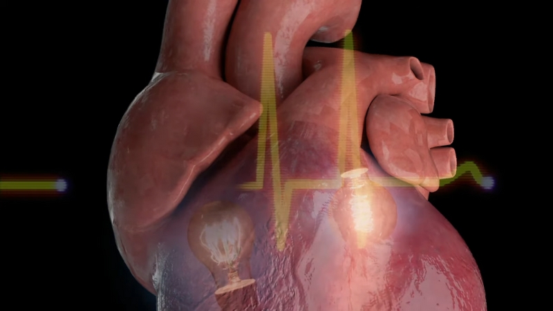 A Detailed 3D Image of The Heart with An Ecg Line, Illustrating Cardiac Catheterization Used to Treat Arrhythmias