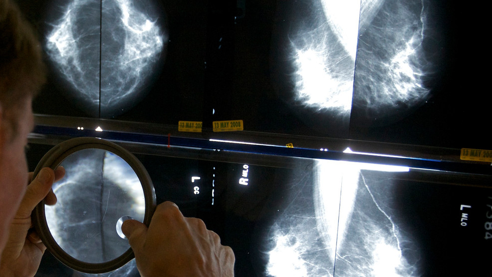 A radiologist uses a magnifying glass to check mammograms for breast cancer in Los Angeles