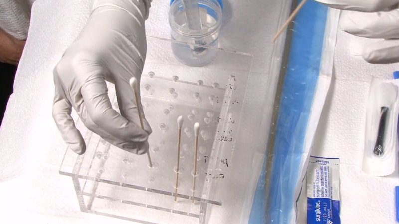 A Forensic Nurse Wearing Gloves Is Handling Swabs During an Evidence Collection Process