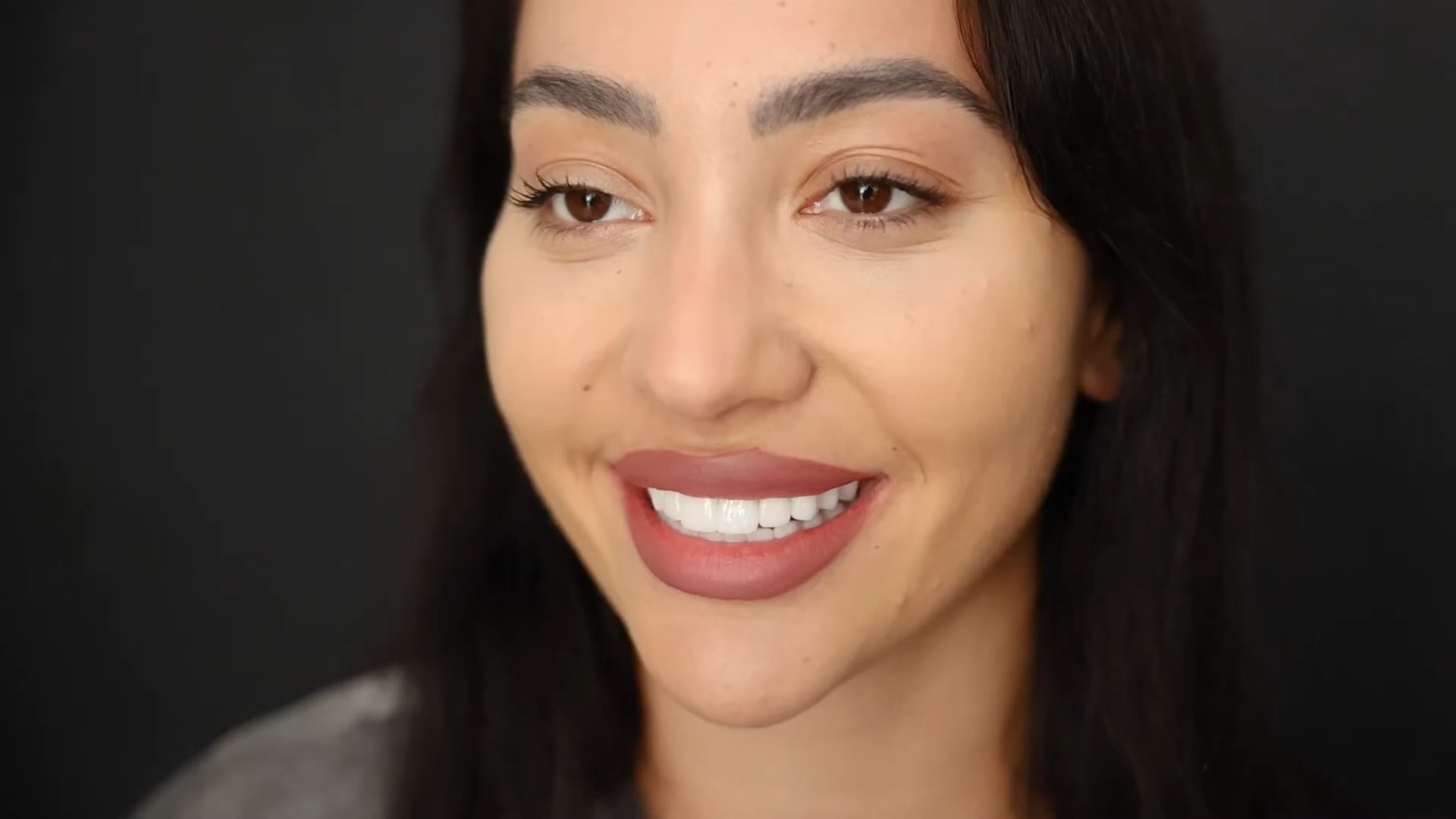 A Woman with A Bright Smile Showing Her Teeth After Getting Veneers in Dubai