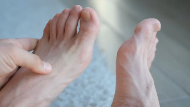 Close-Up of A Person Checking Their Swollen Foot