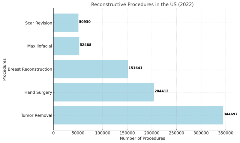 Reconstructive Procedures In The US Chart (2022)