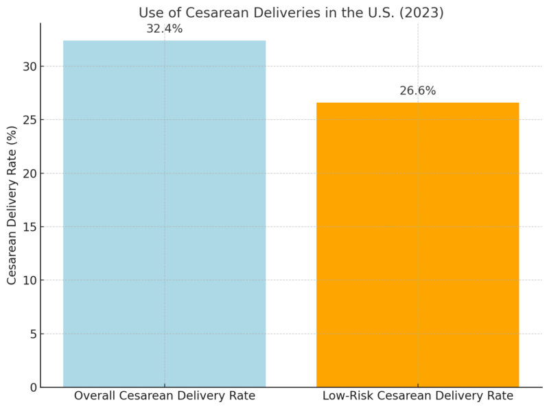 Use Of Cesarean Deliveries In The U.S. Chart (2023)