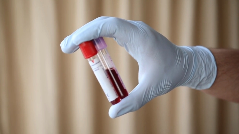 A gloved hand holds two vials of blood, highlighting the importance of rare blood types like Rh null for safe transfusions