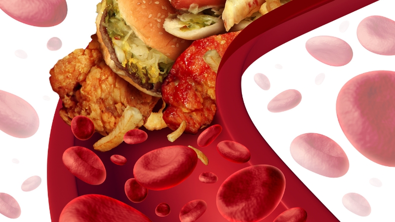 Unhealthy foods linked to high cholesterol shown as a reminder of how diet changes can lower non-HDL cholesterol