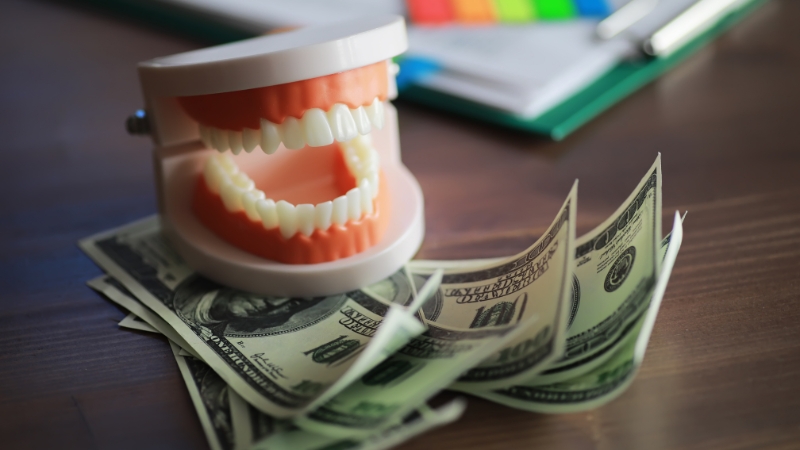 Dental model placed on dollar bills, representing why dental care costs vary across the U.S.