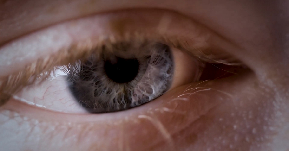 Close-up of a human eye showing detail relevant to an eye treatment story