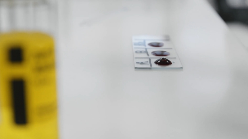 A lab tray shows separated blood samples used for identifying blood types