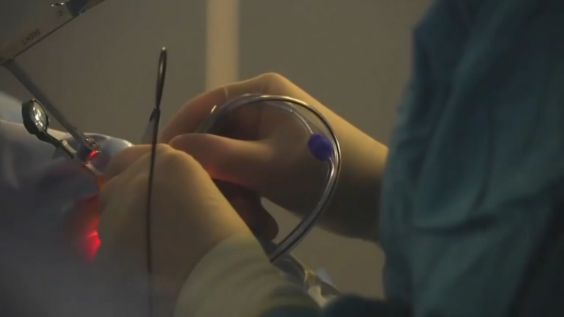 A surgeon performs a delicate eye procedure for a stem cell therapy treatment