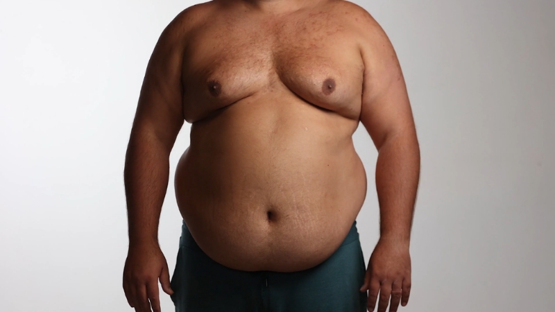 Torso of an overweight adult man showing abdominal body fat against a plain background