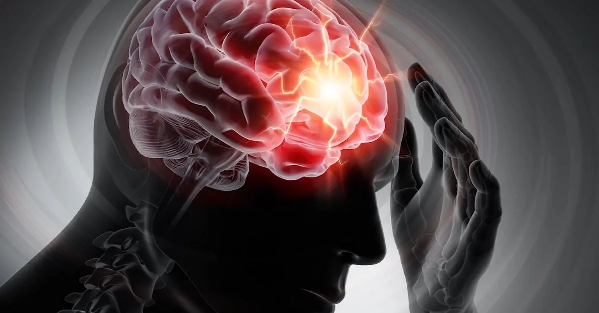 Illustration shows a human head with highlighted brain activity linked to Havana Syndrome symptoms