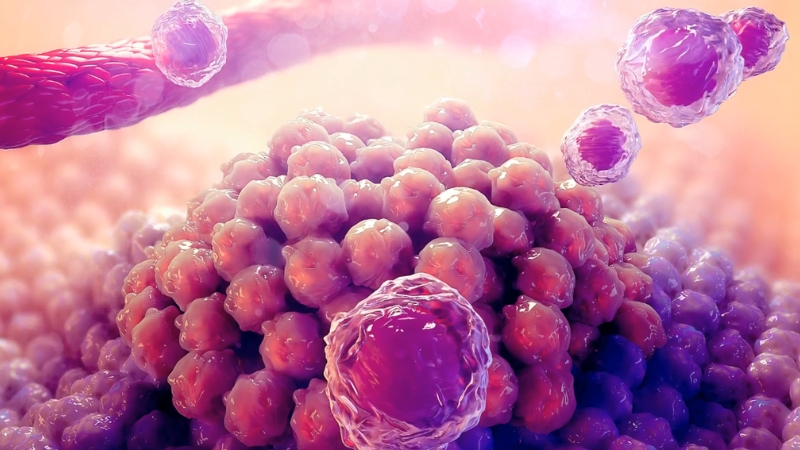 Illustration of cancer cells forming and multiplying inside human tissue