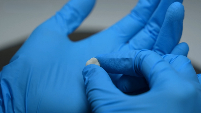 Dentist holding a small ceramic dental crown between gloved fingers for inspection before placement
