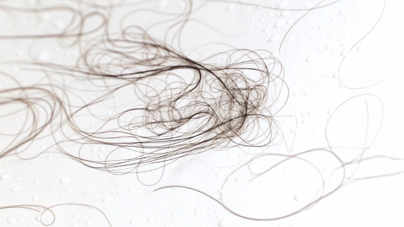 Loose strands of shed hair scattered on a light surface, showing visible hair loss