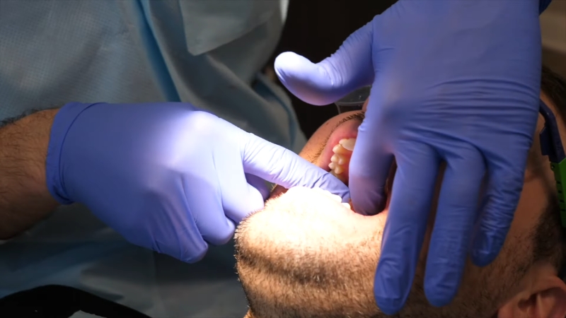 Dentist examining a patient’s jaw and teeth during a TMJ evaluation
