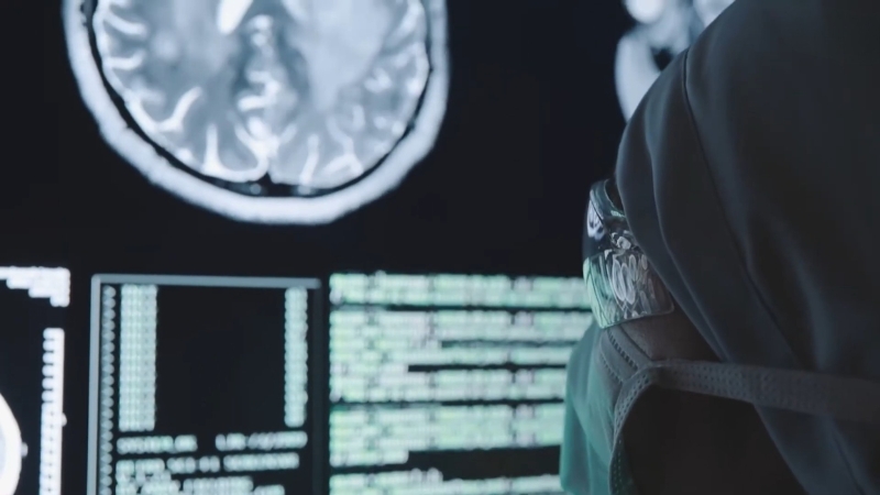Medical professional reviewing brain scans on screens in a hospital