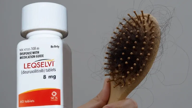 Leqselvi tablets bottle next to a hairbrush filled with shed hair, illustrating treatment for alopecia