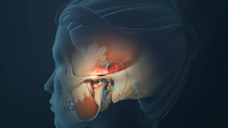 Illustration of the jaw joint area highlighted in red to show temporomandibular joint inflammation