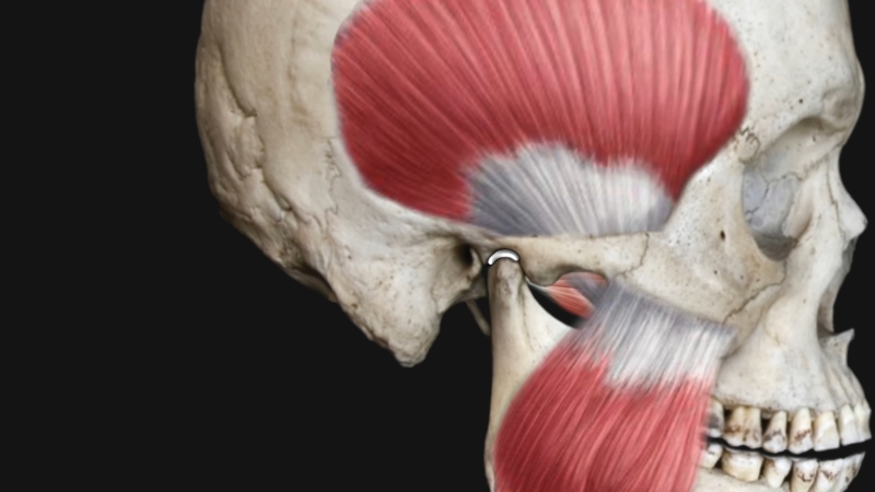 Anatomical illustration of the jaw joint and surrounding muscles related to temporomandibular disorder