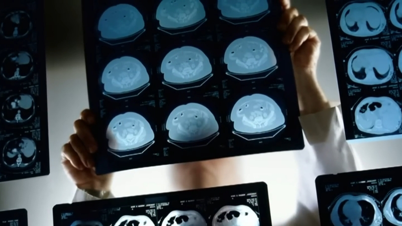 Doctor holds brain scan images to examine brain activity during the first minutes after the heart stops
