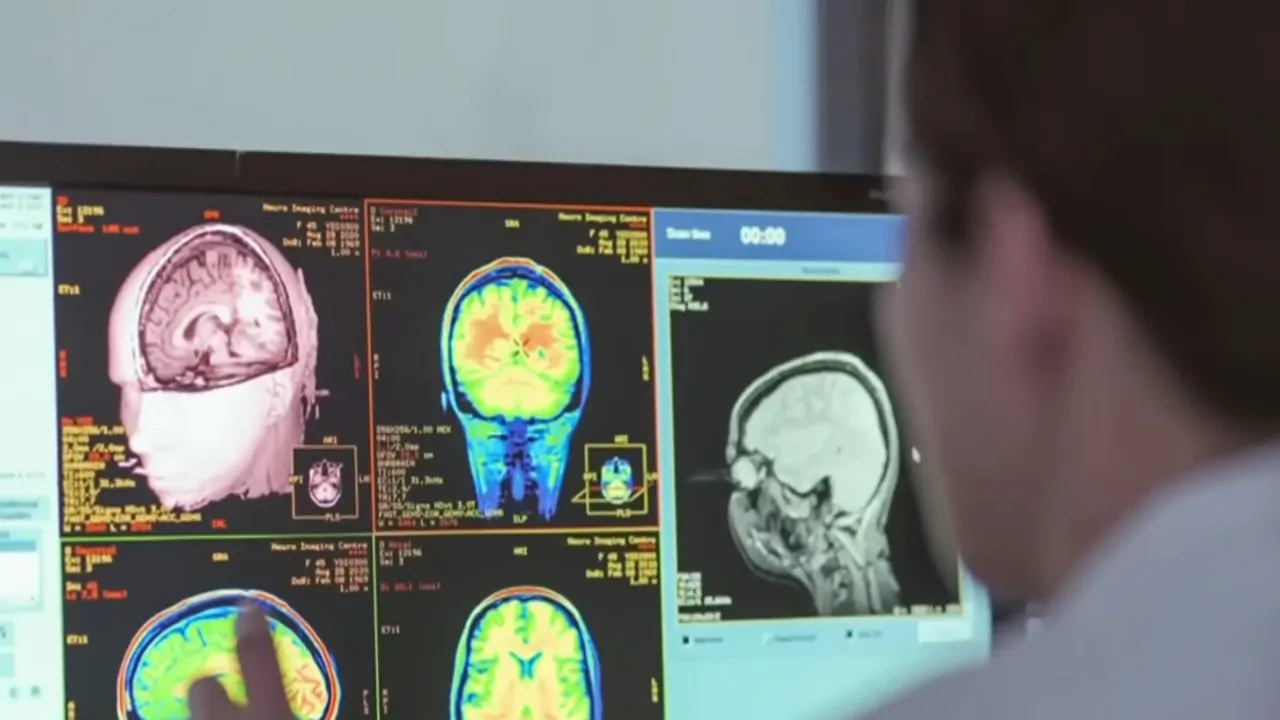 Doctor reviews brain scans on a monitor to study brain activity after the heart stops