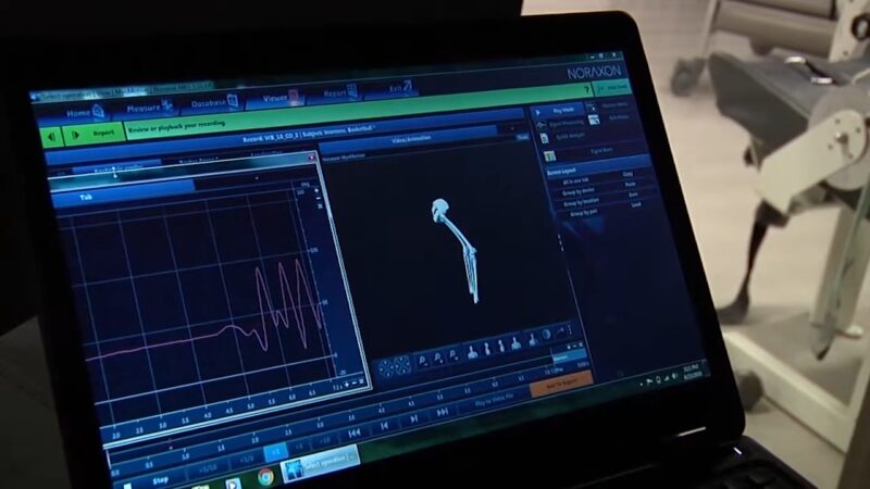 Computer screen shows motion data used in ACL rehabilitation research