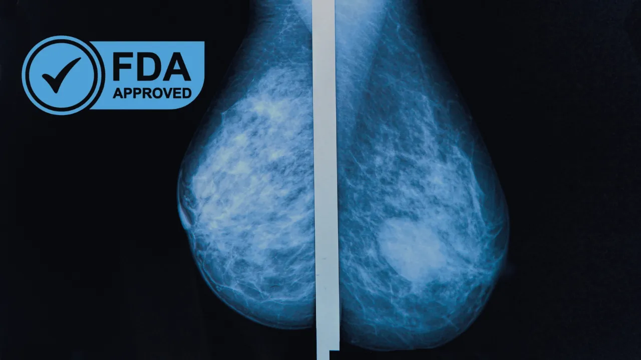 Mammogram image with an FDA approval label for breast cancer risk prediction