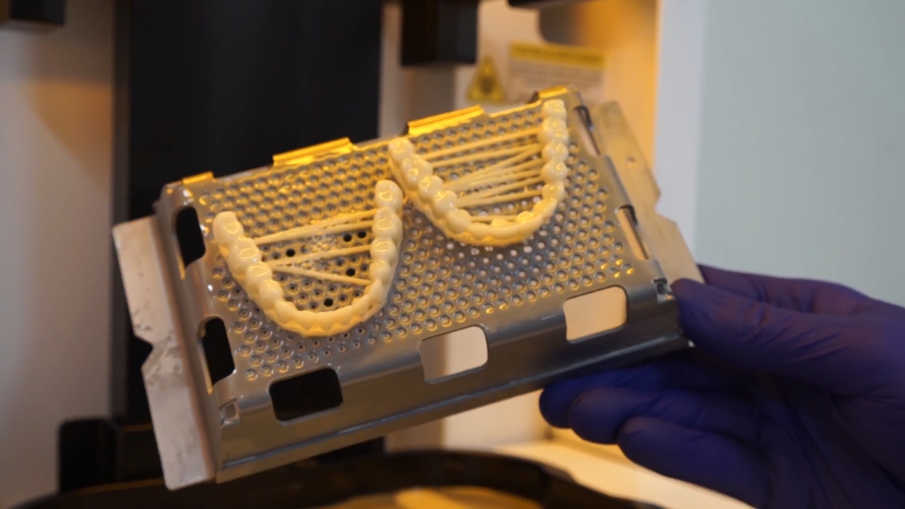 A technician removes printed denture teeth from a 3D printer build tray