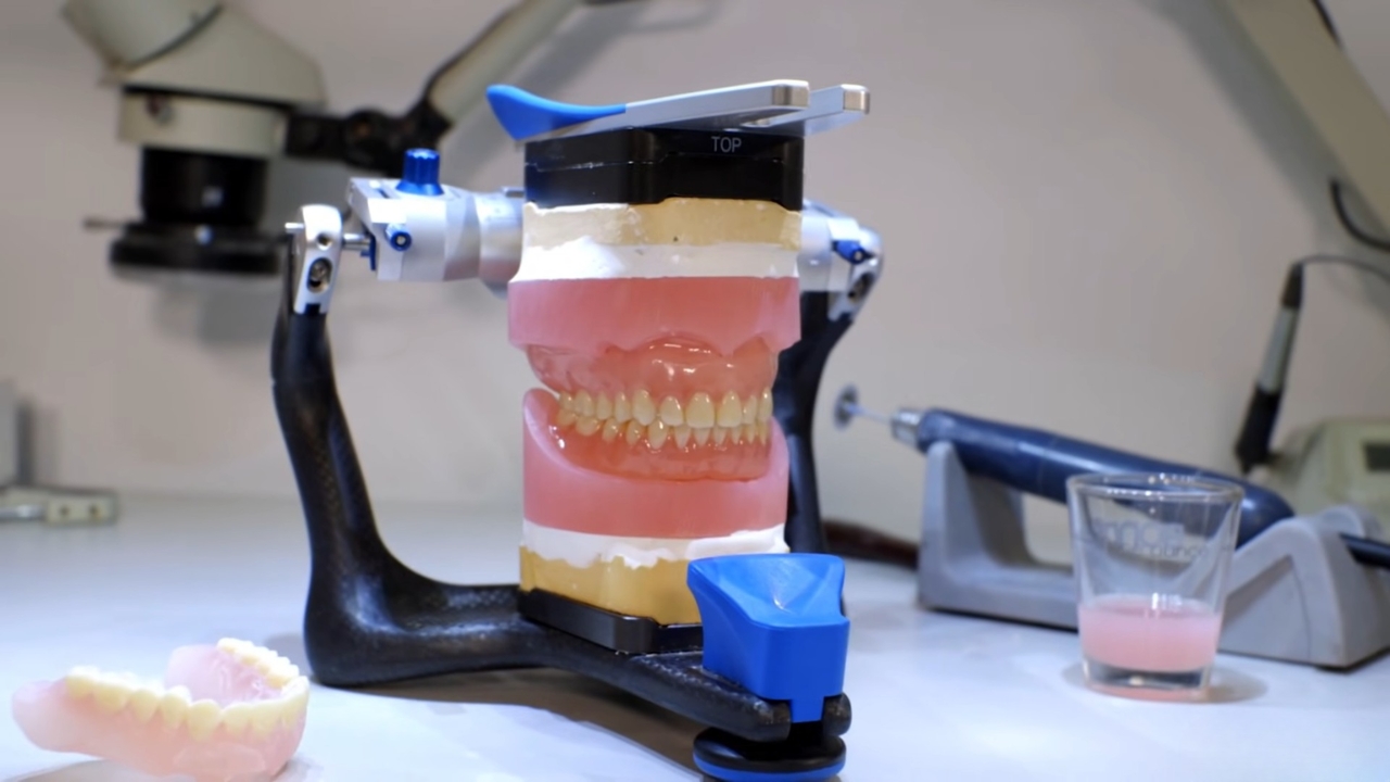 3D printed denture materials are tested on a dental model in a laboratory setting