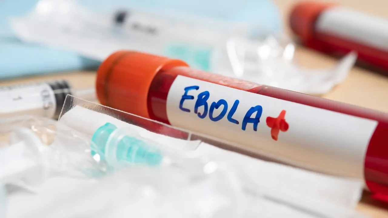 Blood sample tube labeled Ebola during outbreak lab work