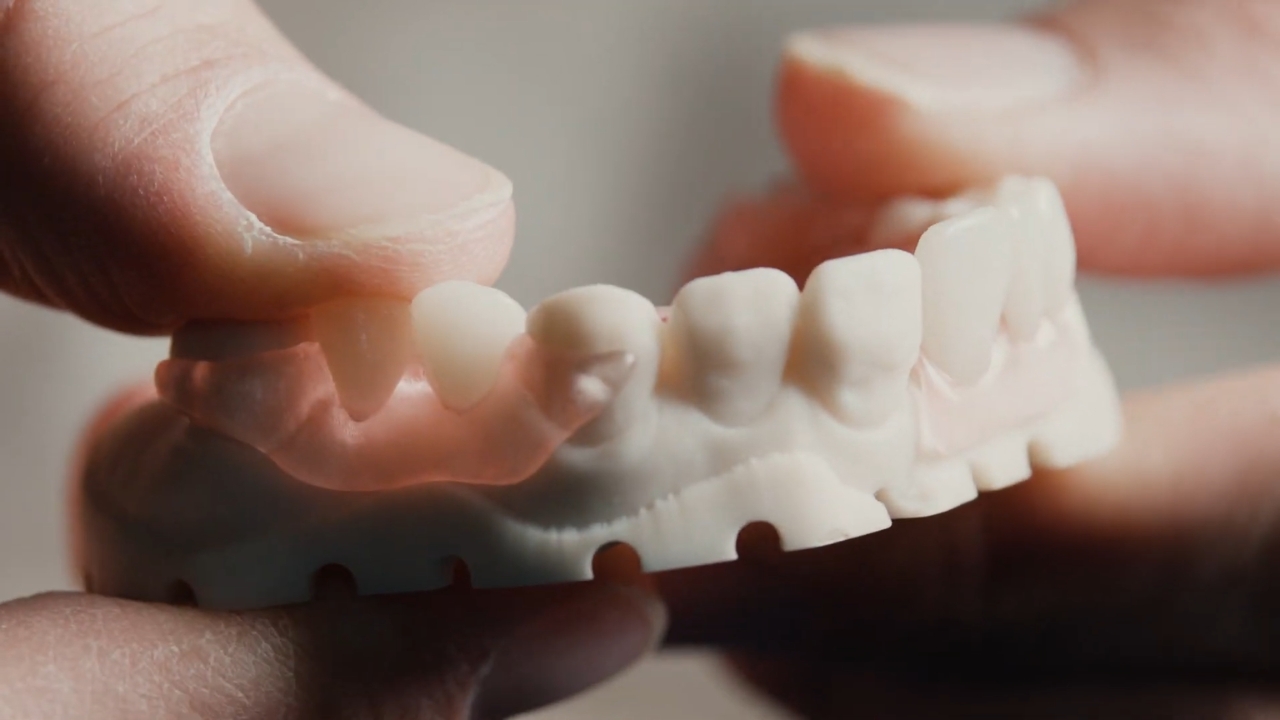 A technician holds a 3D printed denture section to check tooth shape and detail
