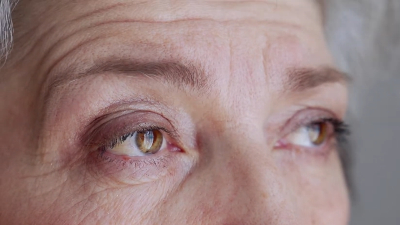 Close-up of an older woman’s eyes at a glaucoma eye exam