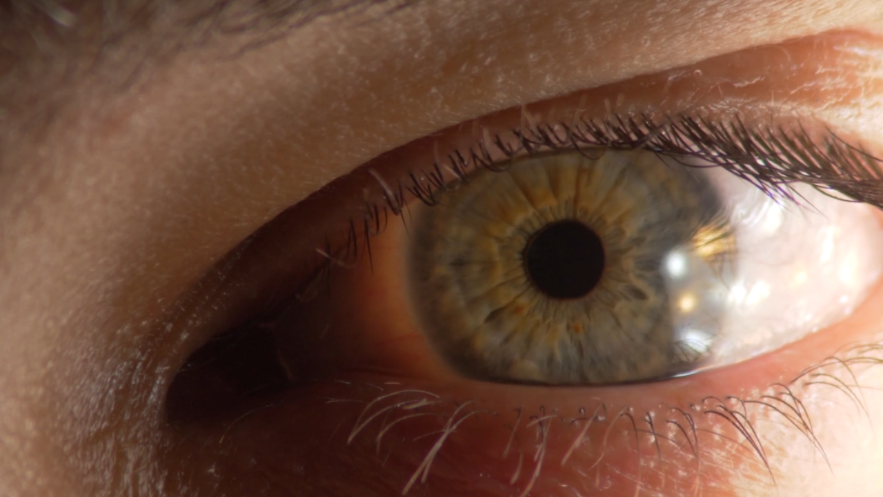 Close-up of a human eye at a glaucoma exam