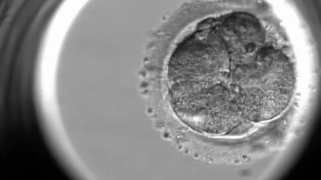 Early-stage embryo viewed under a microscope during IVF treatment.