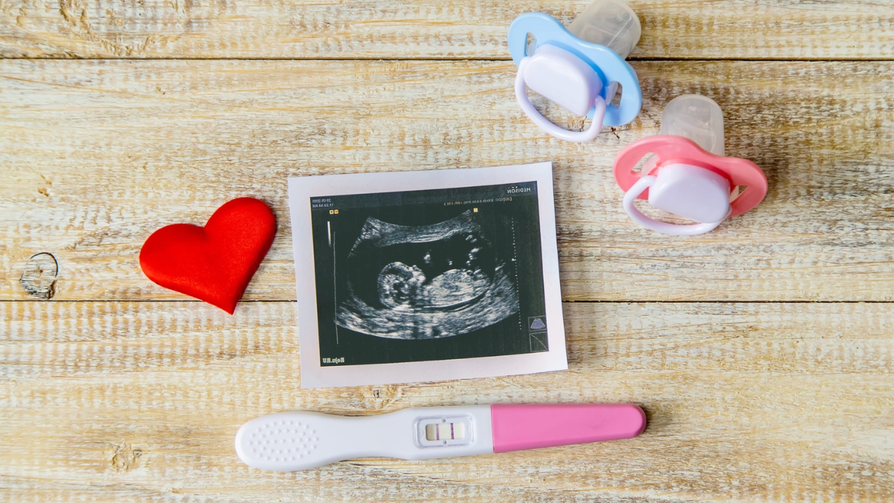 Ultrasound image, pregnancy test, and baby pacifiers on a wooden table.